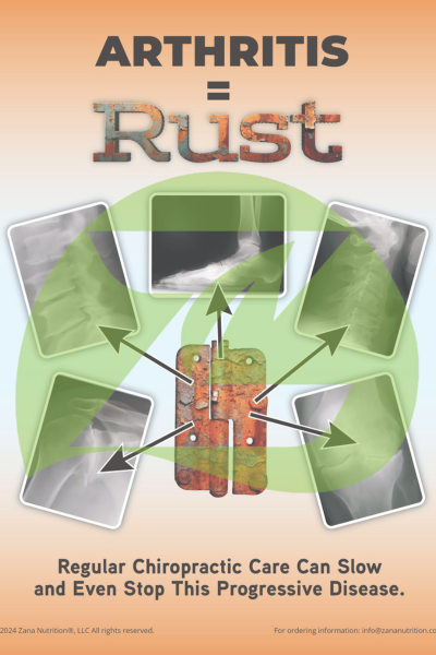 arthritis equals rust diagram