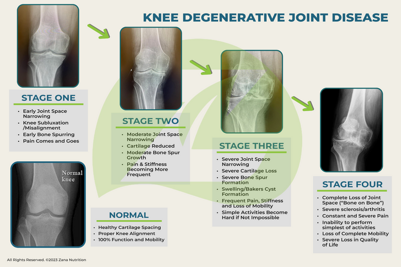 Knee Degeneration