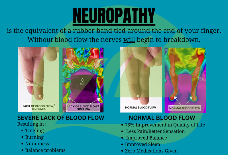Neuropathy Blood Flood