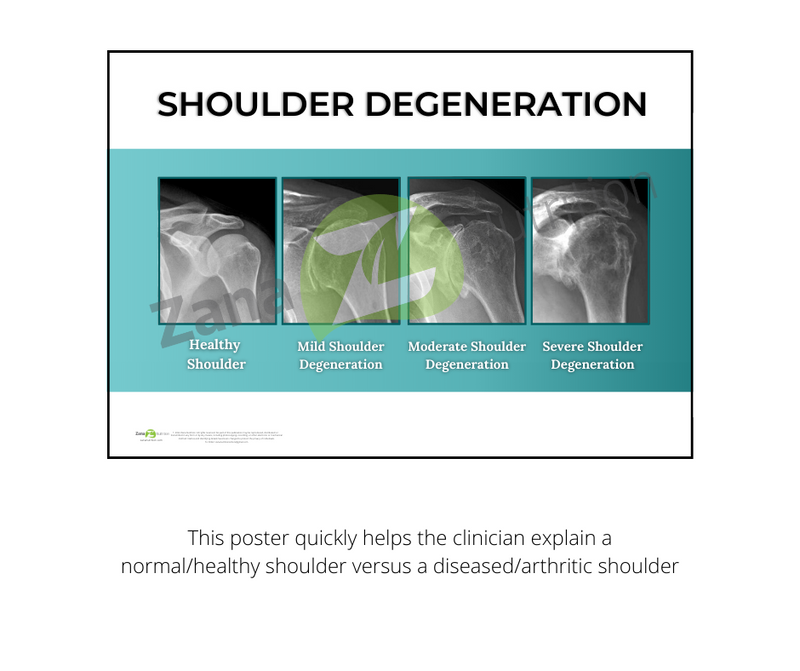 Shoulder Degeneration